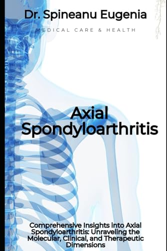 Comprehensive Insights into Axial Spondyloarthritis: Unraveling the Molecular, Clinical, and Therapeutic Dimensions (Medical care and health) von Independently published