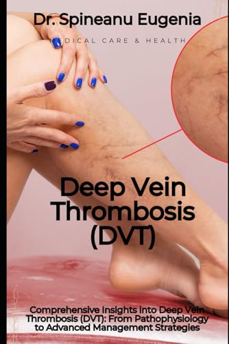 Comprehensive Insights into Deep Vein Thrombosis (DVT): From Pathophysiology to Advanced Management Strategies von Independently published