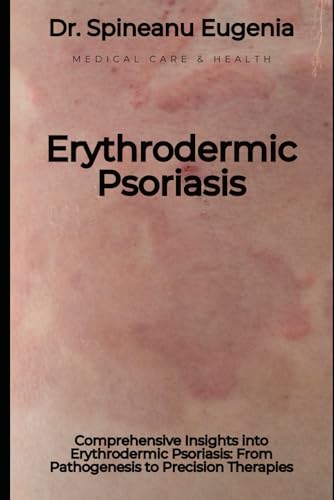 Comprehensive Insights into Erythrodermic Psoriasis: From Pathogenesis to Precision Therapies von Independently published