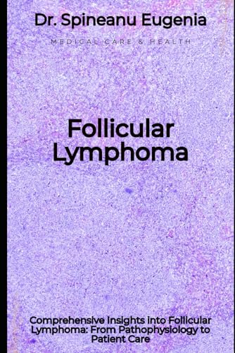 Comprehensive Insights into Follicular Lymphoma: From Pathophysiology to Patient Care von Independently published