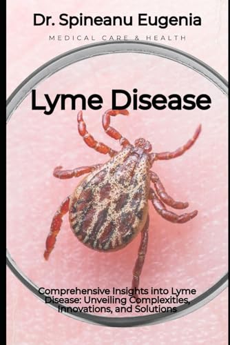 Comprehensive Insights into Lyme Disease: Unveiling Complexities, Innovations, and Solutions (Medical care and health) von Independently published