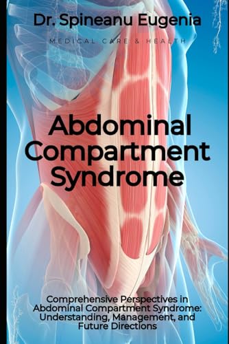 Comprehensive Perspectives in Abdominal Compartment Syndrome: Understanding, Management, and Future Directions (Medical care and health) von Independently published