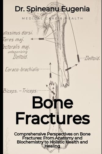 Comprehensive Perspectives on Bone Fractures: From Anatomy and Biochemistry to Holistic Health and Healing (Medical care and health) von Independently published