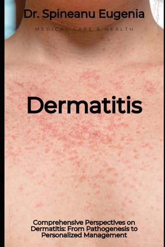 Comprehensive Perspectives on Dermatitis: From Pathogenesis to Personalized Management von Independently published