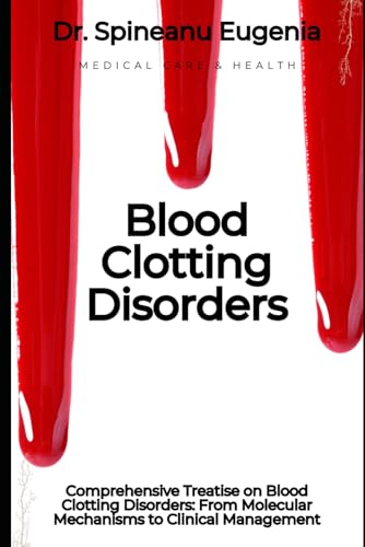 Comprehensive Treatise on Blood Clotting Disorders: From Molecular Mechanisms to Clinical Management (Medical care and health) von Independently published