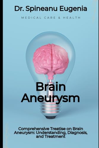 Comprehensive Treatise on Brain Aneurysm: Understanding, Diagnosis, and Treatment (Medical care and health) von Independently published