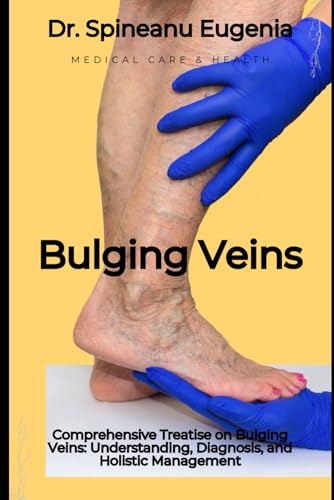 Comprehensive Treatise on Bulging Veins: Understanding, Diagnosis, and Holistic Management (Medical care and health) von Independently published