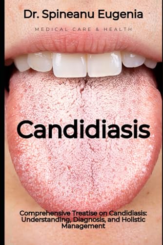 Comprehensive Treatise on Candidiasis: Understanding, Diagnosis, and Holistic Management (Medical care and health)