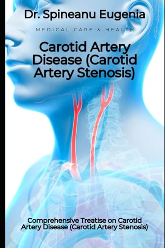 Comprehensive Treatise on Carotid Artery Disease (Carotid Artery Stenosis) (Medical care and health) von Independently published