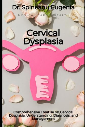 Comprehensive Treatise on Cervical Dysplasia: Understanding, Diagnosis, and Management von Independently published