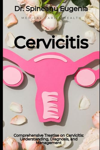 Comprehensive Treatise on Cervicitis: Understanding, Diagnosis, and Management von Independently published