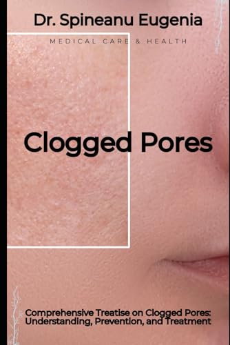 Comprehensive Treatise on Clogged Pores: Understanding, Prevention, and Treatment von Independently published