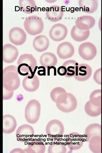 Comprehensive Treatise on Cyanosis: Understanding the Pathophysiology, Diagnosis, and Management von Independently published