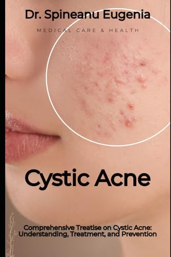 Comprehensive Treatise on Cystic Acne: Understanding, Treatment, and Prevention von Independently published