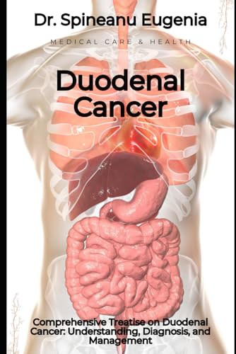 Comprehensive Treatise on Duodenal Cancer: Understanding, Diagnosis, and Management von Independently published