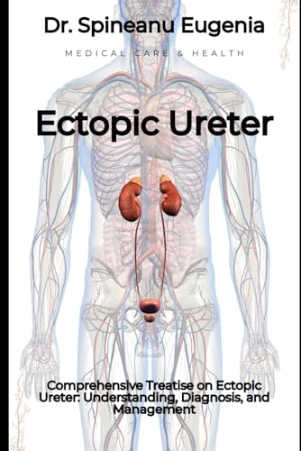 Comprehensive Treatise on Ectopic Ureter: Understanding, Diagnosis, and Management von Independently published