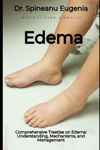 Comprehensive Treatise on Edema: Understanding, Mechanisms, and Management von Independently published