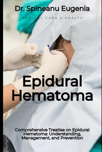 Comprehensive Treatise on Epidural Hematoma: Understanding, Management, and Prevention von Independently published