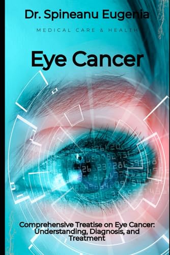 Comprehensive Treatise on Eye Cancer: Understanding, Diagnosis, and Treatment von Independently published
