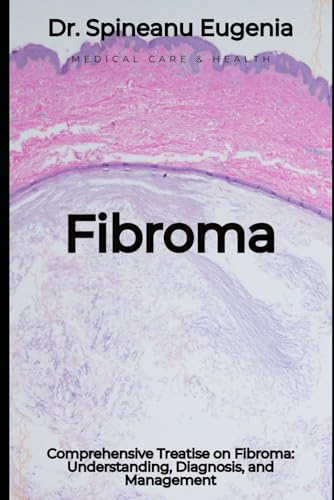 Comprehensive Treatise on Fibroma: Understanding, Diagnosis, and Management von Independently published