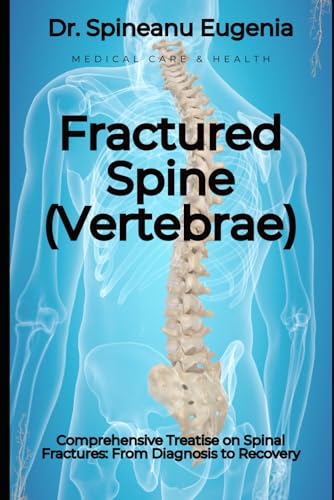 Comprehensive Treatise on Fractured Spine (Vertebrae): From Diagnosis to Recovery von Independently published