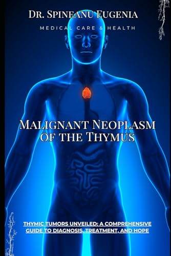 Comprehensive Treatise on Malignant Neoplasm of the Thymus (Medical care and health) von Independently published