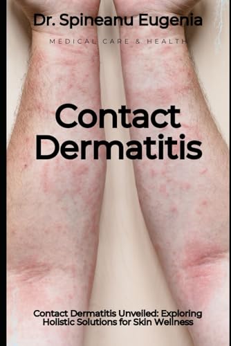 Contact Dermatitis Unveiled: Exploring Holistic Solutions for Skin Wellness von Independently published