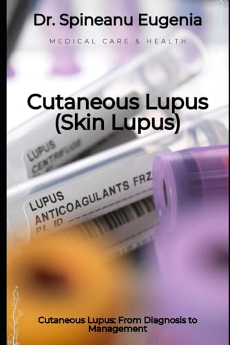 Cutaneous Lupus: From Diagnosis to Management von Independently published