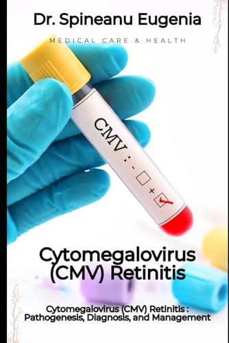 Cytomegalovirus (CMV) Retinitis : Pathogenesis, Diagnosis, and Management von Independently published