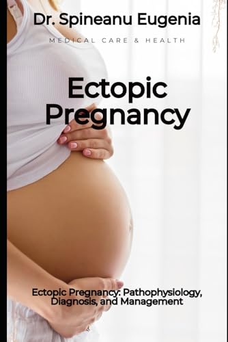 Ectopic Pregnancy: Pathophysiology, Diagnosis, and Management von Independently published