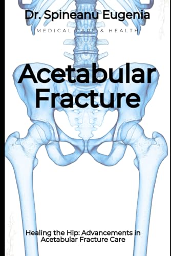 Healing the Hip: Advancements in Acetabular Fracture Care (Medical care and health) von Independently published