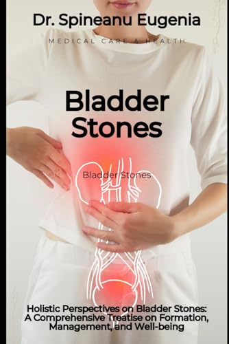 Holistic Perspectives on Bladder Stones: A Comprehensive Treatise on Formation, Management, and Well-being (Medical care and health) von Independently published