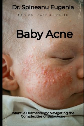 Infantile Dermatology: Navigating the Complexities of Baby Acne (Medical care and health) von Independently published