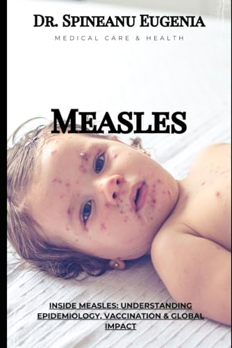 Inside Measles: Understanding Epidemiology, Vaccination & Global Impact (Medical care and health) von Independently published