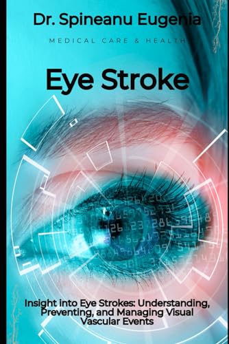 Insight into Eye Strokes: Understanding, Preventing, and Managing Visual Vascular Events von Independently published