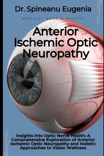 Insights into Optic Nerve Health: A Comprehensive Exploration of Anterior Ischemic Optic Neuropathy and Holistic Approaches to Vision Wellness (Medical care and health) von Independently published