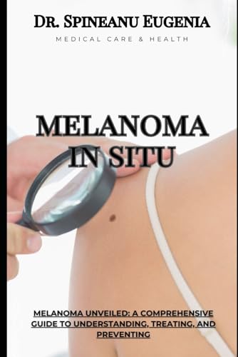 Melanoma Unveiled: A Comprehensive Guide to Understanding, Treating, and Preventing (Medical care and health) von Independently published
