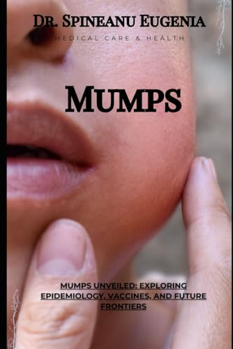 Mumps Unveiled: Exploring Epidemiology, Vaccines, and Future Frontiers (Medical care and health) von Independently published