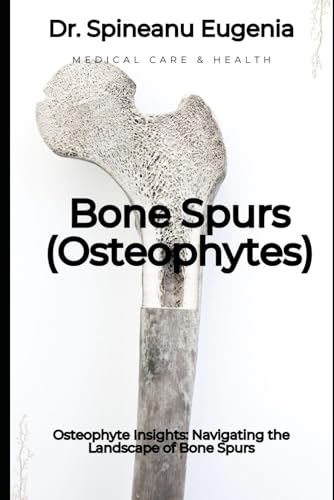 Osteophyte Insights: Navigating the Landscape of Bone Spurs (Medical care and health) von Independently published