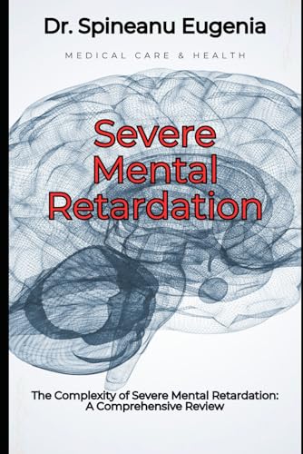 The Complexity of Severe Mental Retardation: A Comprehensive Review (Medical care and health) von Independently published