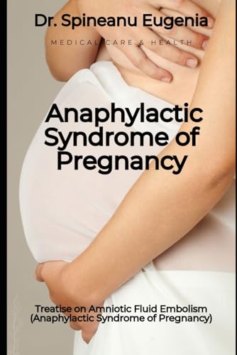 Treatise on Amniotic Fluid Embolism (Anaphylactic Syndrome of Pregnancy) (Medical care and health) von Independently published