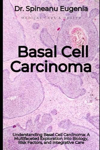 Understanding Basal Cell Carcinoma: A Multifaceted Exploration into Biology, Risk Factors, and Integrative Care (Medical care and health) von Independently published
