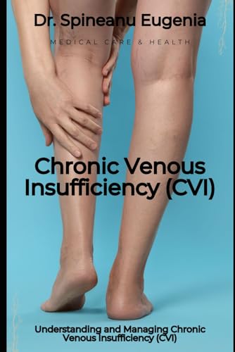 Understanding and Managing Chronic Venous Insufficiency (CVI) von Independently published