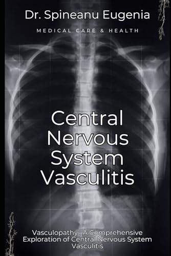 Vasculopathy : A Comprehensive Exploration of Central Nervous System Vasculitis von Independently published