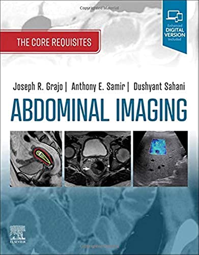 Abdominal Imaging: The Core Requisites von Elsevier
