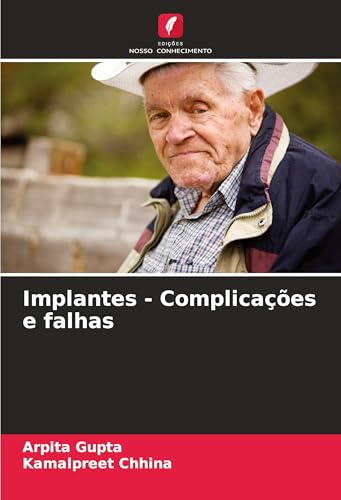 Implantes - Complicações e falhas: DE von Edições Nosso Conhecimento