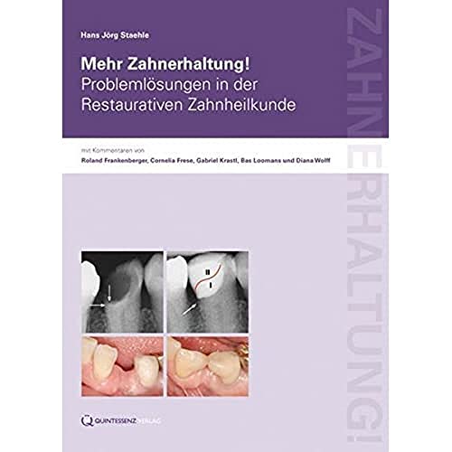 Mehr Zahnerhaltung!: Problemlösungen in der Restaurativen Zahnheilkunde von Quintessenz Verlag