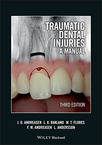 Traumatic Dental Injuries: A Manual von Wiley
