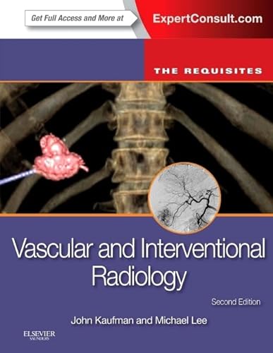 Vascular and Interventional Radiology: The Requisites: Expert Consult - Online and Print (The Core Requisites) von Saunders