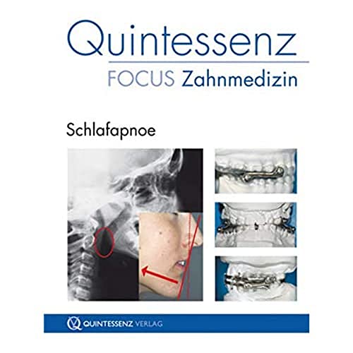Quintessenz Focus Zahnmedizin: Schlafapnoe von Quintessenz, Berlin